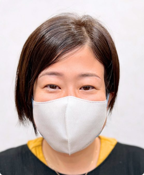 まばら眉 → 一体感のある自然な眉に（施術後）
