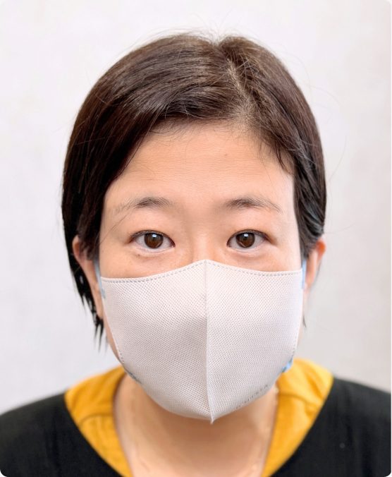 まばら眉 → 一体感のある自然な眉に（施術前）