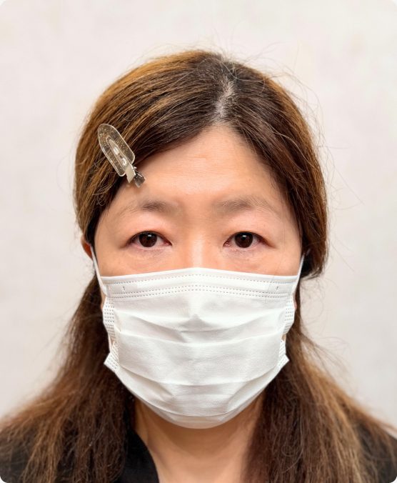 薄眉 → 一体感のある自然な眉に（施術前）