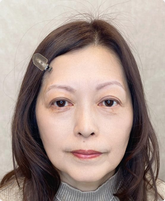 上がり眉 → お顔のバランスに合ったセミアーチ眉に（施術前）