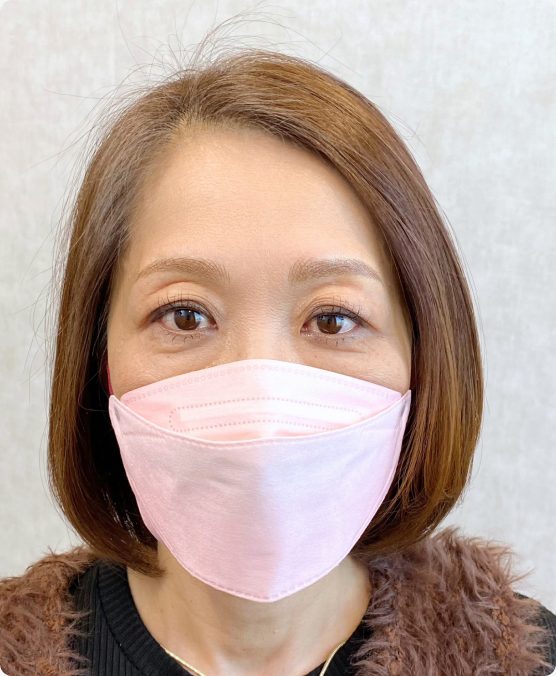 眉なし → 骨格ベースで本体の眉の位置に（施術後）