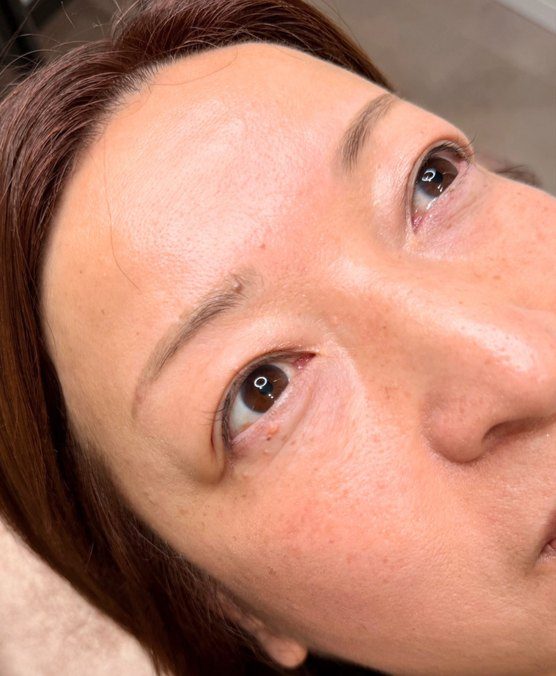 アイライン → 浮かない極細アイライン（施術前）